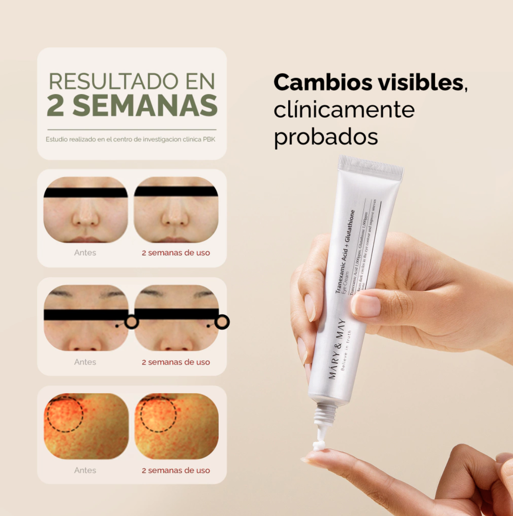 TRANEXAMIC ACID + GLUTATHIONE EYE CREAM 